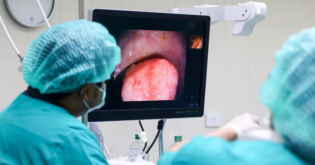endoscopic ultrasound scan services in Gurgaon