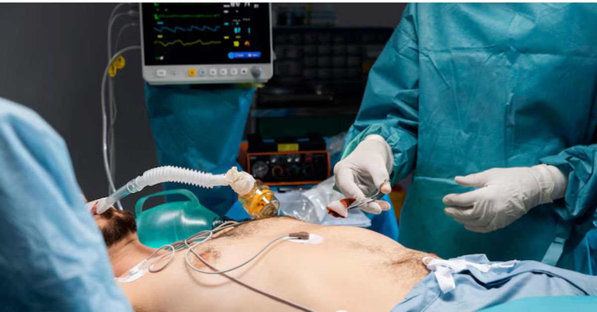 ERCP in Gurgaon, ERCP doctor in Gurgaon