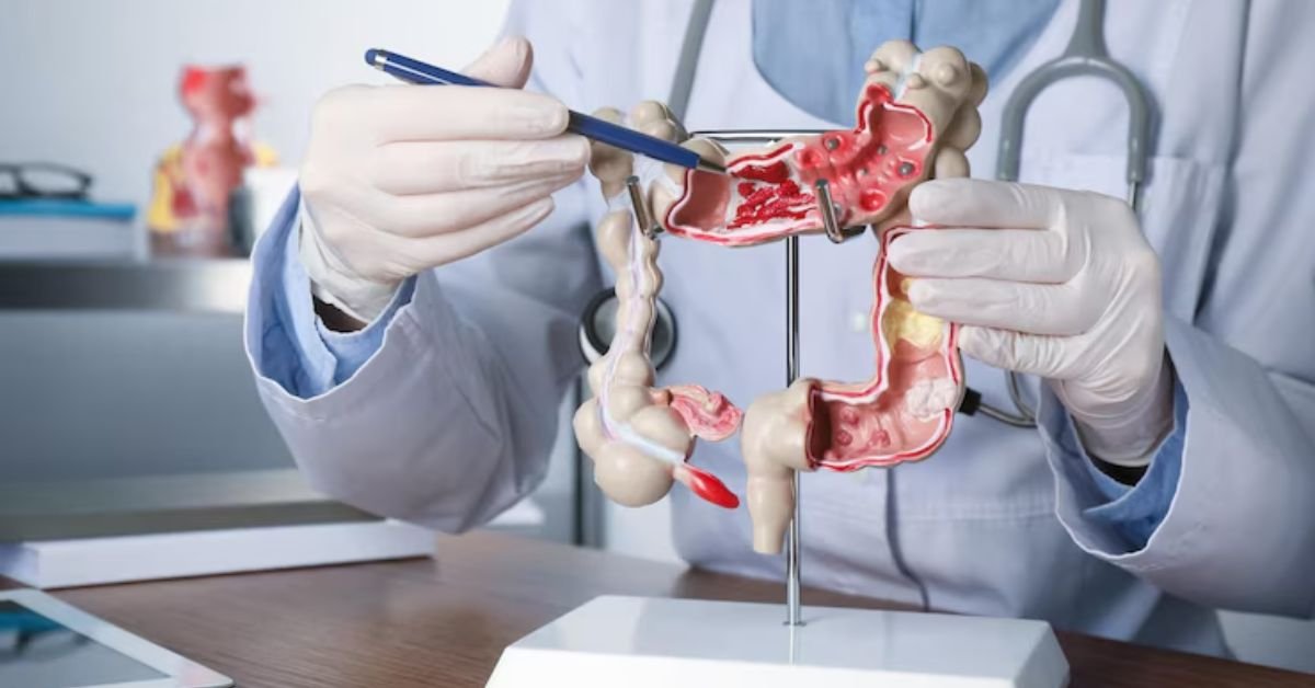 gastroenterologist in gurugram, best gastroenterologist in gurugram