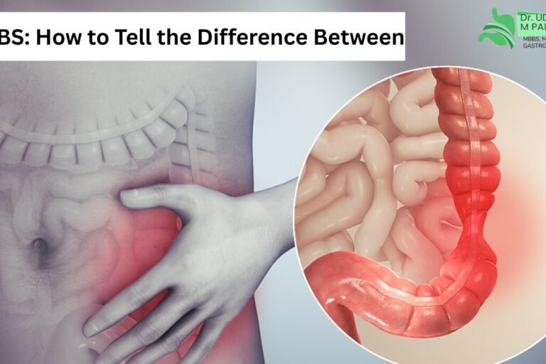 gurugram.webp IBS vs gas symptoms and bloating