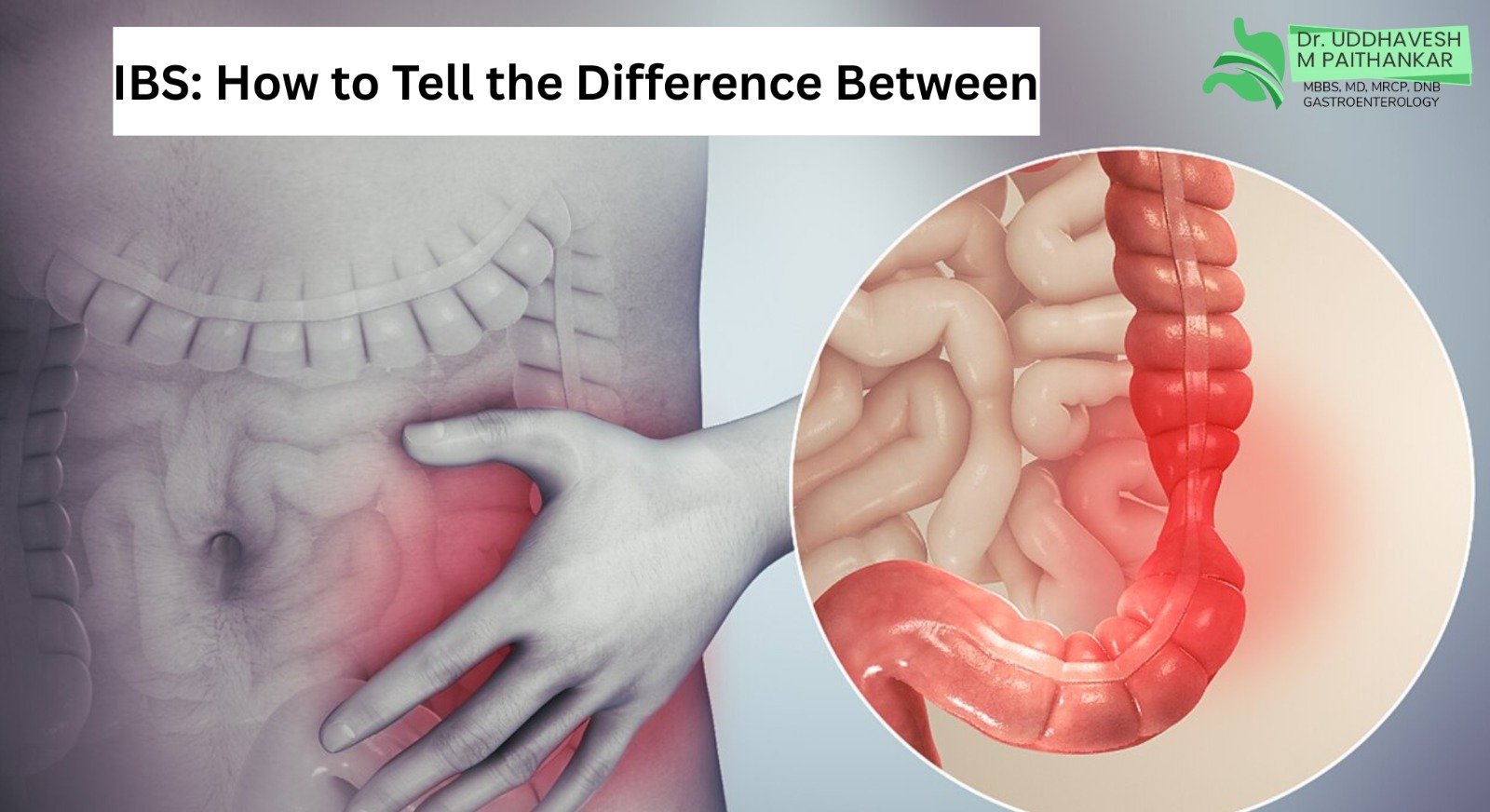 gurugram.webp IBS vs gas symptoms and bloating gurugram.webp IBS vs gas symptoms and bloating